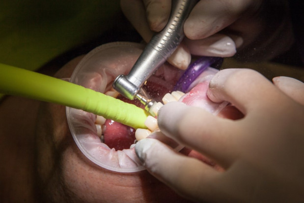 Staż podyplomowy ze znakami zapytania ze strony KS NRL (foto: pixabay) Zmiany w stażu podyplomowym lekarzy dentystów – obiekcje KS NRL