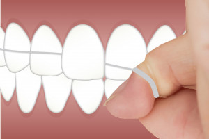 Nici dentystyczne z toksynami (foto: pixabay) Toksyny w niciach dentystycznych?