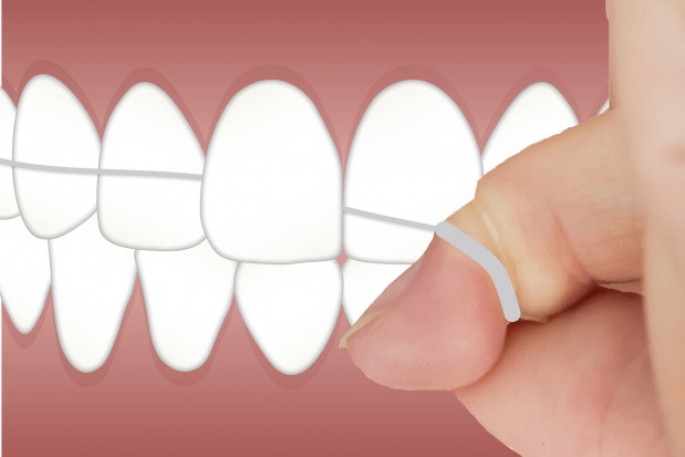 Nici dentystyczne z toksynami (foto: pixabay) Toksyny w niciach dentystycznych?