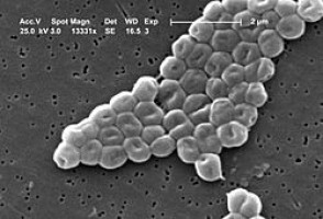 Acinetobacter baumannii często powoduje zakażenia u pacjentów wymagających dużej ilości procedur inwazyjnych (źródło: Wikipedia) Naukowcy: kolejny etap w walce z opornością na antybiotyki