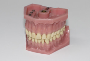 Potrzeba uregulowania zawodów jak technika dentystyczna i higiena stomatologiczna (foto: pixabay) Higiena stomatologiczna i technika dentystyczna do uregulowania