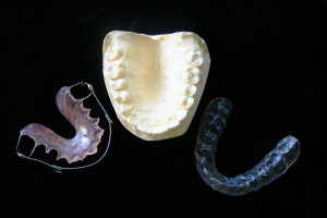 Ortodonta poszukiwany (foto: pixabay) OW NFZ w Lublinie poszukuje ortodonty