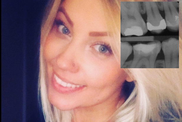 Problemy z zębami Harriet Weyman (foto: FB) 12 tys. funtów za brak rezultatów leczenia stomatologicznego