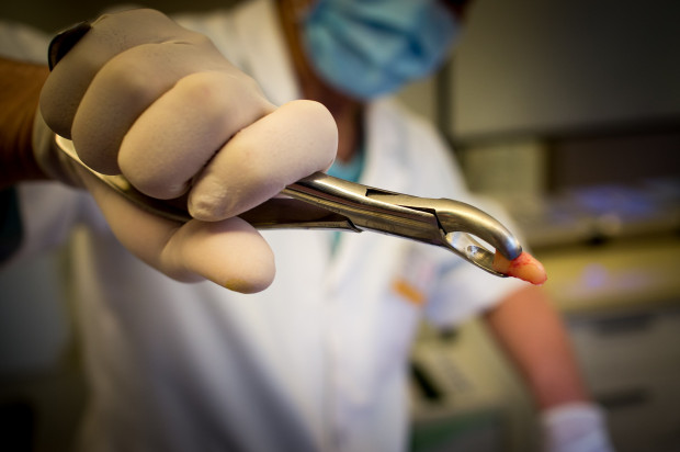 Niemiecki dentysta stanął przed sądem z zarzutem dokonania obrażeń ciała z premedytacją (fot. pixabay) Półtora roku więzienia za ekstrakcję 22 zębów
