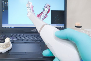Dentysta zarchiwizuje uzębienie (foto: archiwum) Klony „uśmiechu” nieuświadomiona konieczność?