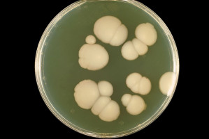 Candida albicans, drożdżak najczęściej wywołujący grzybicze zapalenie śluzówki jamy ustnej (fot. Wikipedia) Leczenie kandydozy jamy ustnej: jak nie lekiem to głodem