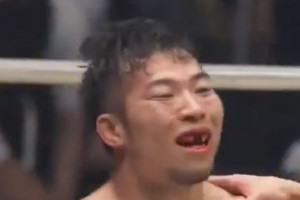 Japończyk Yusaku Nakamura z pamiątką po MMA MMA: czy jest na sali dentysta?