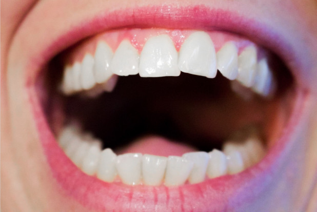Kampania Dentysto wesprzyj projekt PTS