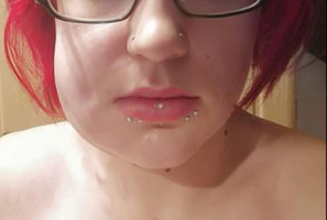 Po usunięciu zęba mądrości Sepsa po usunięciu zęba mądrości