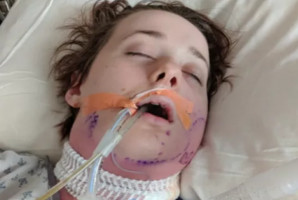 Usunięcie zębów groźne dla życia Ekstrakcja zębów zakończona sepsą