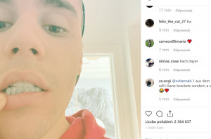 Justin Bieber prezentuje nowy aparat ortodontyczny (fot. Instagram) Justin Bieber zainwestował w korektę zgryzu