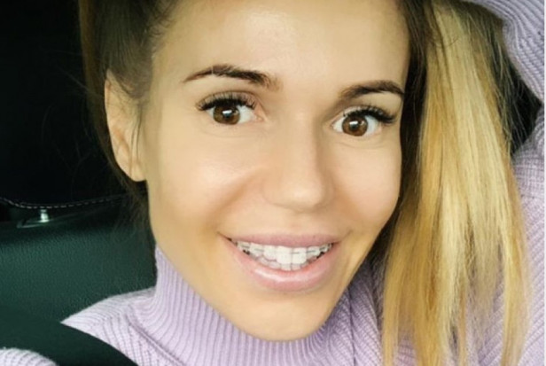 Dorota Rabczewska-Stępień w aparacie ortodontycznym (fot. Instagram) Doda rozumnie o leczeniu wady zgryzu