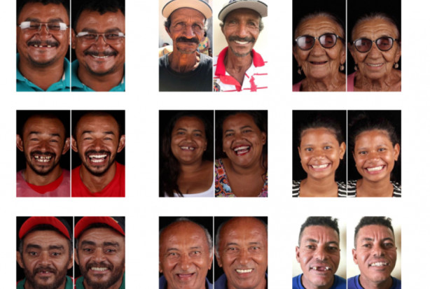 Pacjenci dentysty Felipe Rossi Dentysta brazylijskim Judymem