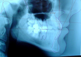 Diagnostyka w gabinecie stomatologicznym (foto: pixabay) Dostawcy sprzętu RTG dla stomatologii wypełnią nowe obowiązki