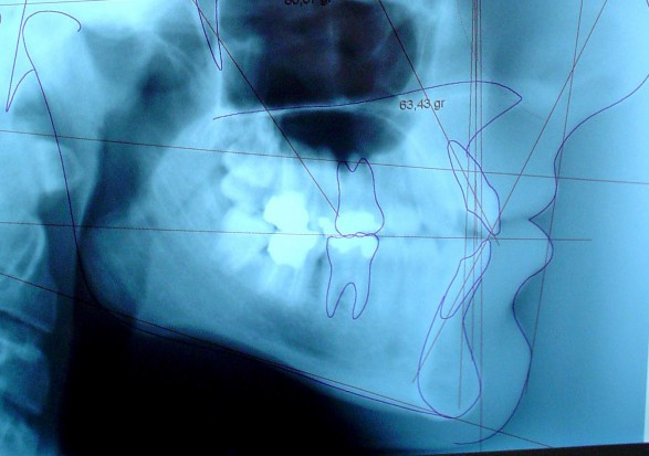 Diagnostyka w gabinecie stomatologicznym (foto: pixabay) Dostawcy sprzętu RTG dla stomatologii wypełnią nowe obowiązki