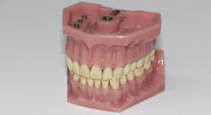 Pacjenci narzekają na jakość protez zębowych na NFZ