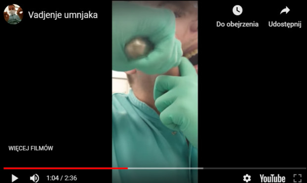 Usuwanie ósemki Usuń sobie ząb mądrości