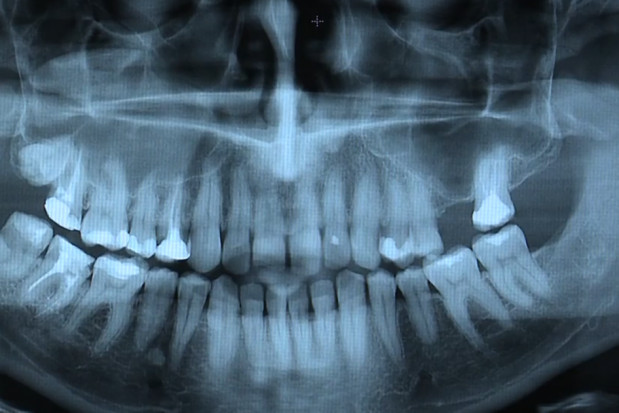 Nowe obowiązki dla stomatologów wynikają z aktualnej ustawy Prawo atomowe (fot. pixabay) NIL przypomina o formalnościach z zakresu radiologii
