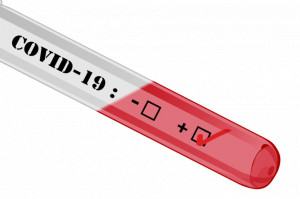 Więcej testów w kierunku koronawirusa (foto; pixabay) NRL: powinno się robić zdecydowanie więcej testów wykrywających SARS-Cov-2