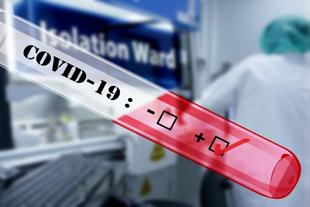 Liczba testów w kierunku COVID-19 (foto: pixabay) Koronawirus: Polska - bardzo mało testów na tle Europy