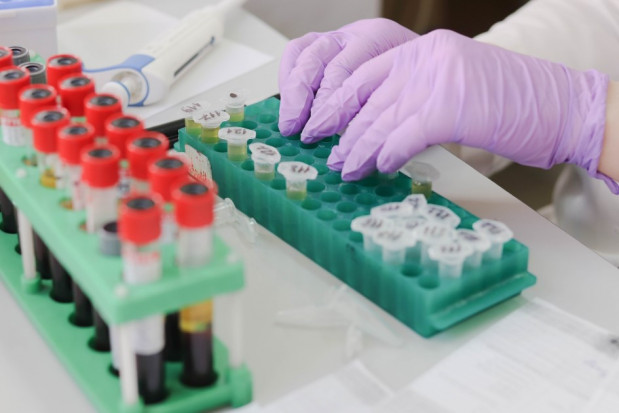 MZ zapowiada więcej testów na COVID-19 (foto: pixabay) Koronawirus: wydajność laboratoriów wzrośnie do 20 tys. testów na dobę