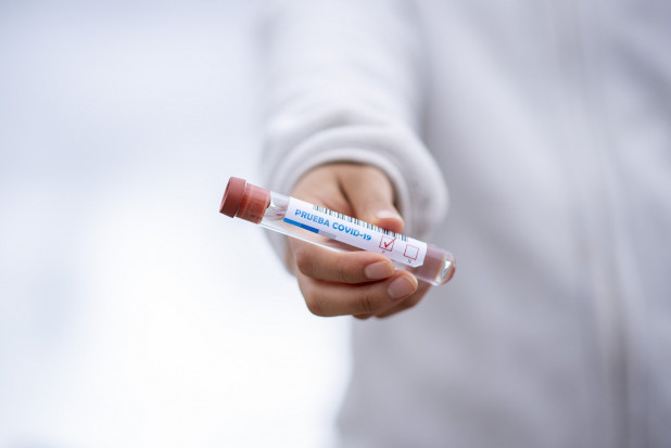 Stosowanie testów przesiewowych w Polsce tylko na bardziej zaawansowanym etapie epidemii (fot. pixabay) Koronawirus: za wcześnie na powszechne stosowanie testów serologicznych