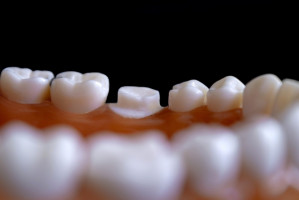 Leczenie zębów zawsze pod pręgierzem zakażenia (foto: pixabay) Pacjent zakażony u dentysty: procedury bezpieczeństwa nie są nowością