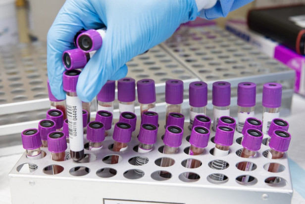 Wciąż pojawia się 300 - 500 przypadków dziennie w kraju (foto: pixabay) Jak epidemia potoczy się w Polsce? - ocenia prof. Krzysztof Simon
