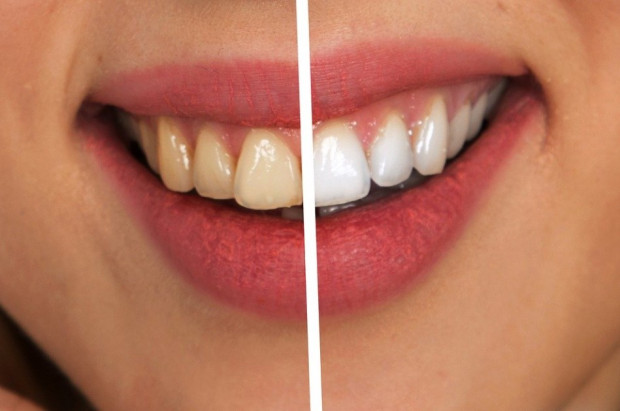 Polacy czekają na wznowienie świadczeń stomatologicznych (foto: pixabay) Spokojnie, Polacy deklarują zamiar szybkiego udania się do dentysty
