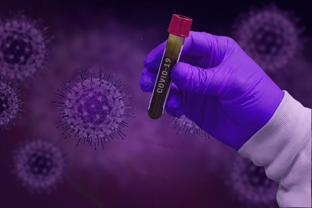 COVID-19 testy komercyjne (foto: pixabay) Koronawirus: komercyjne badania diagnostyczne nie są przez MZ ograniczanie