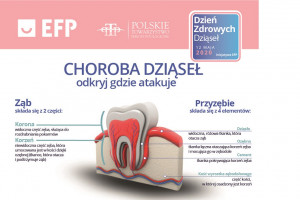 12 maja Światowy Dzień Zdrowych Dziąseł Polskie Towarzystwo Periodontologiczne aktywne podczas Światowego Dnia Zdrowych Dziąseł