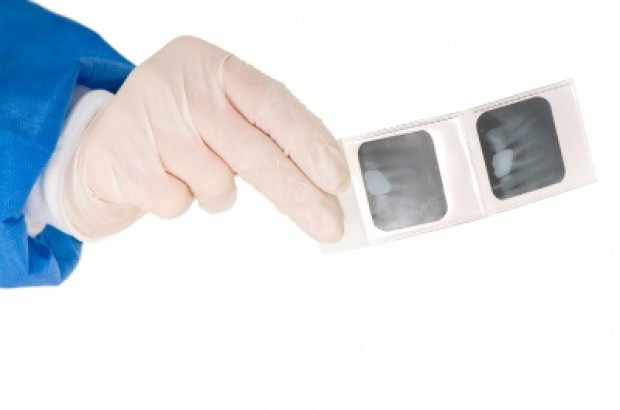 Koronawirus: zalecenia PTS w sprawie wykonywania stomatologicznych zdjęć rentgenowskich