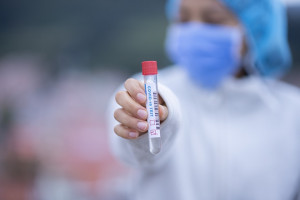 Koronawirus: konsultanci krajowi nie rekomendują przesiewowych testów wykrywających przeciwciała