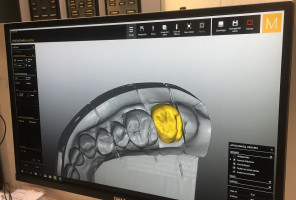 Stomatologia cyfrowa (foto: pxhere) Dentyści uporczywie pytają NFZ o telemedycynę