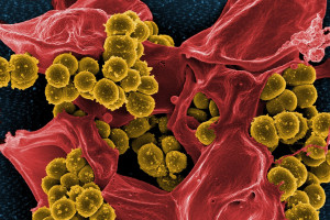 Bakterie (w większości) jako sojusznicy zdrowia