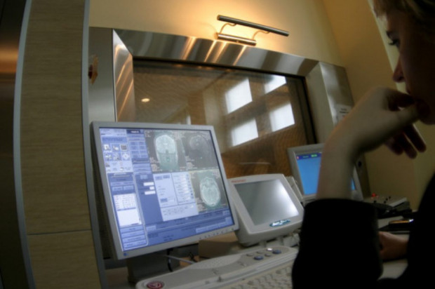 Nowoczesne metody obrazowania posłużyły do diagnozy diprosopus (fot. Archiwum) Noworodek z dwiema jamami ustnymi