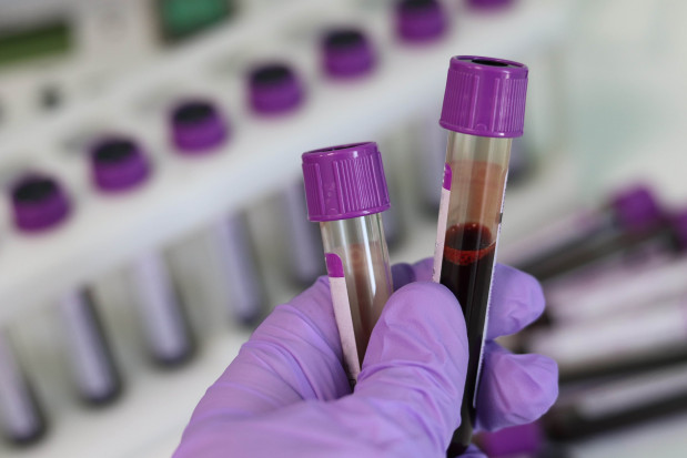 Wykazanie obecności przeciwciał nie identyfikuje osób zakażonych (fot. pixabay) Eksperci o diagnostyce SARS-CoV-2