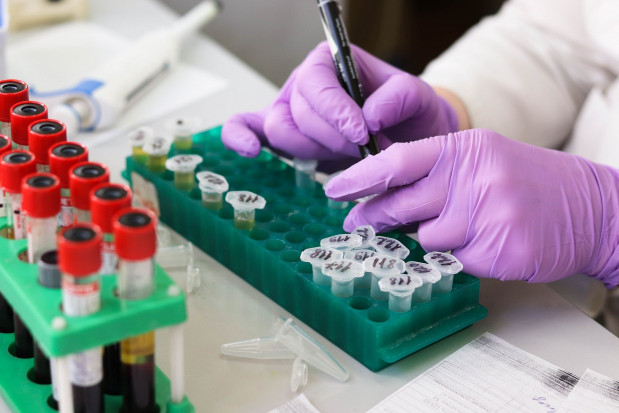 Koszt testu na koronawirusa wynosi 330 zł do 550 zł (fot. pixabay) Testy na SARS-CoV-2 przed leczeniem stomatologicznym w szpitalu