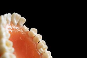 Profilaktyka próchnicy zębów wśród młodzieży (foto: pixabay) Ruszy II runda konkursu MZ na profilaktykę próchnicy zębów wśród młodzieży
