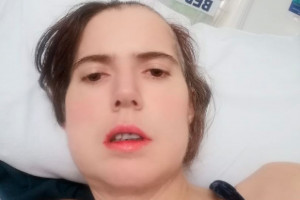 Rebeka Dalton: wszystko zaczęło się od ropnia zęba Ropień zęba przyczyną śmiertelnego zagrożenia