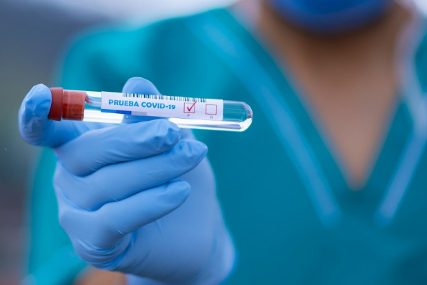 Testowanie koronawirusa (foto: pixabay) Testowanie obecności SARS-CoV-2 w niecałą minutę