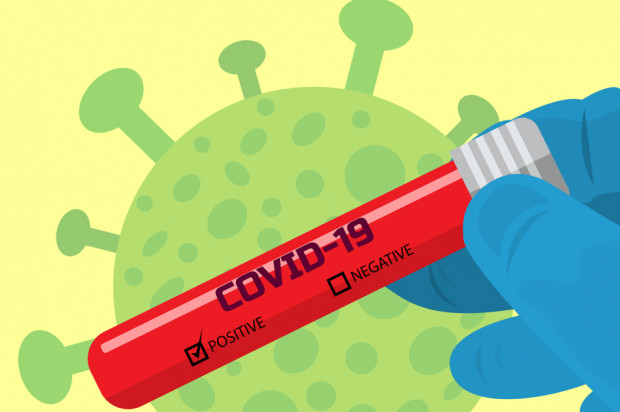 Nowe polskie technologie w walce z epidemią (fot. pixabay) Możliwa już masowa diagnostyka koronawirusa