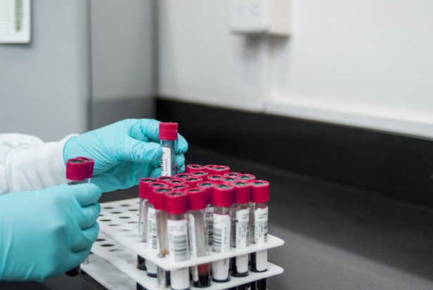 Przesiewowe testy PCR nie dla uczestników staży zawodowych w podmiotach leczniczych