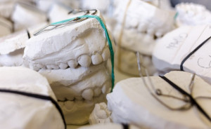 Asystent poszukiwany do Zakładu Technik Dentystycznych UM w Białymstoku (fot. pixabay) UM w Białystoku: praca w Zakładzie Technik Dentystycznych