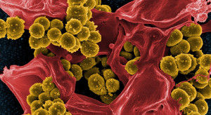 Mikrobiom jamy ustnej przyczyną raka jamy ustnej!