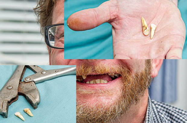 Dentysta na własny użytek Zamienił fotel stomatologiczny na kombinerki