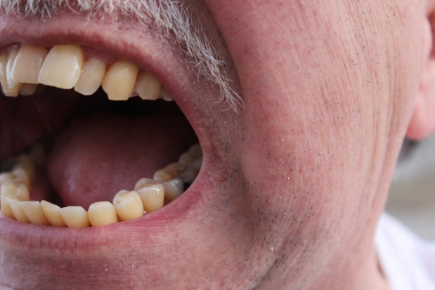 Gniew pacjentów powszechny (foto: pixabay) Lżą i atakują fizycznie dentystów