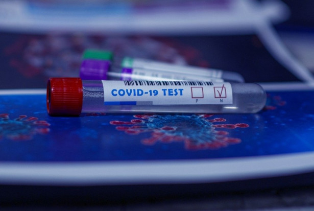 WIL dofinansuje lekarzom testy na obecność SARS-Cov-2