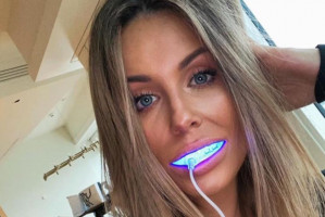 Małgorzata Rozenek wybiela zęby i ogłasza to na Instagramie