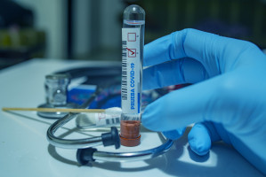 Stan epidemii (fot. pixabay) Koronawirus 13 listopada: 24 051 zakażeń